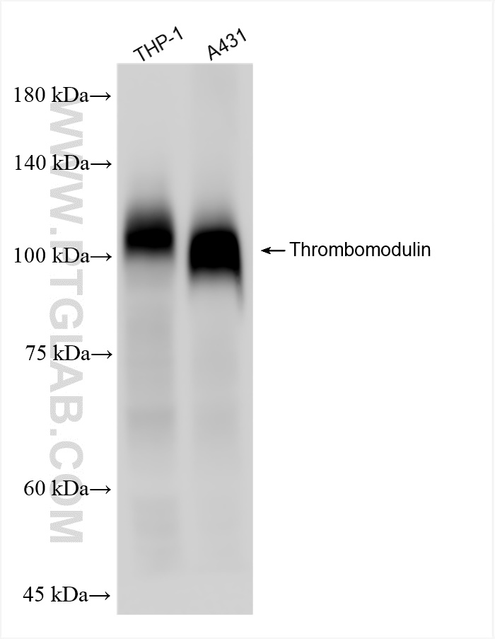 Western Blot (WB) analysis of various lysates using Thrombomodulin Recombinant antibody (83416-4-RR)