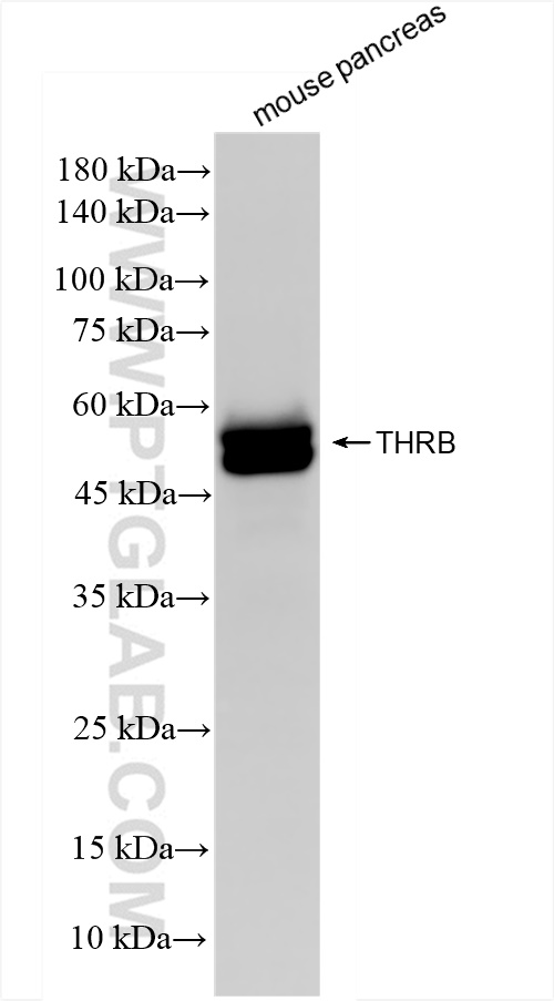 Western Blot (WB) analysis of mouse pancreas tissue using Thyroid Hormone Receptor beta Recombinant antibody (83866-2-RR)