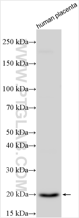 Western Blot (WB) analysis of various lysates using Timp-3 Polyclonal antibody (31652-1-AP)