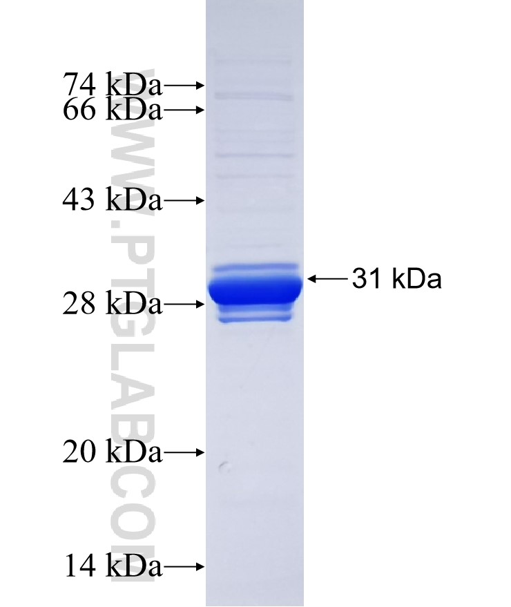 Timp-3 fusion protein Ag34657 SDS-PAGE