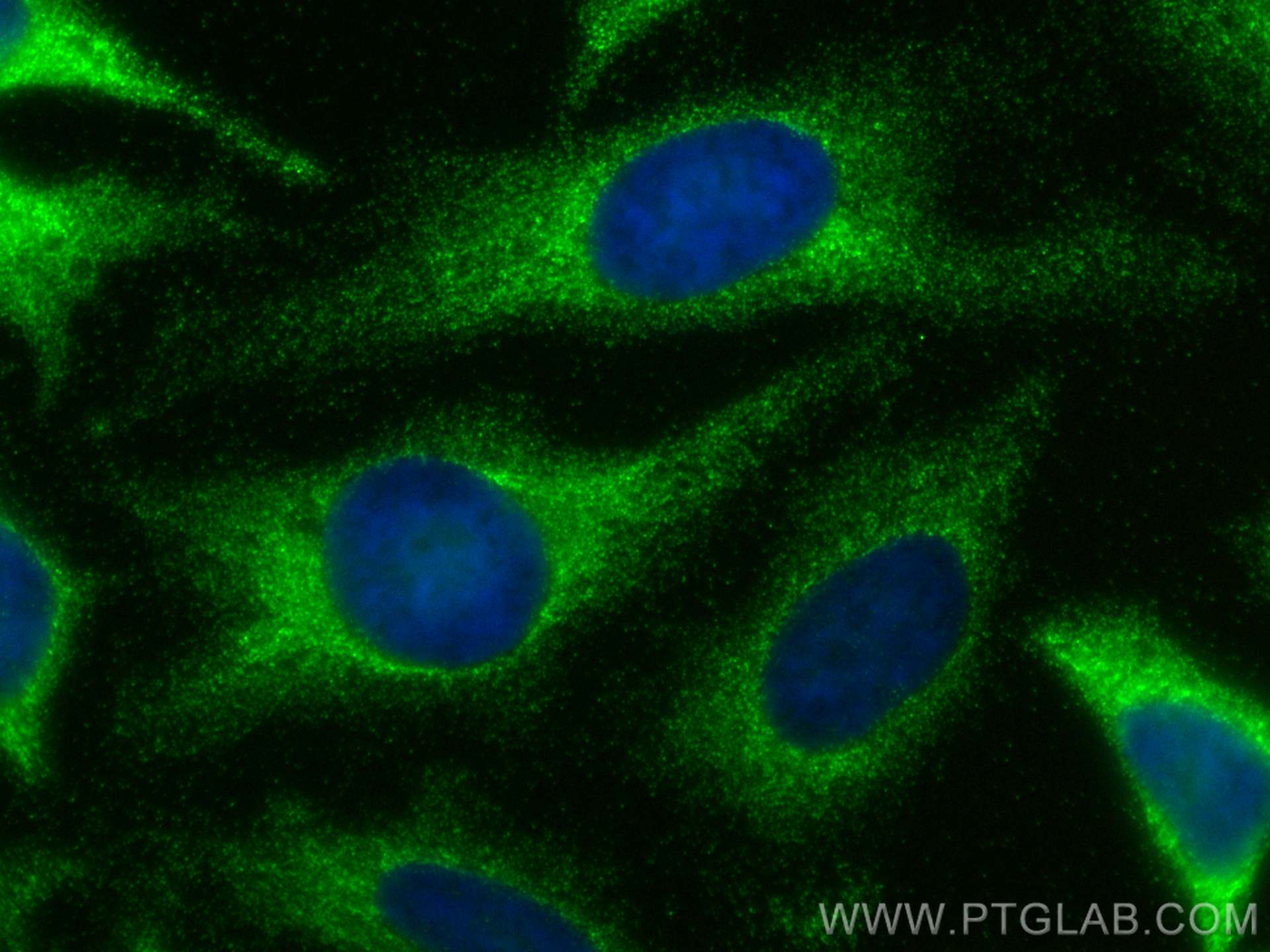 Immunofluorescence (IF) / fluorescent staining of HeLa cells using Timp1 Polyclonal antibody (30869-1-AP)