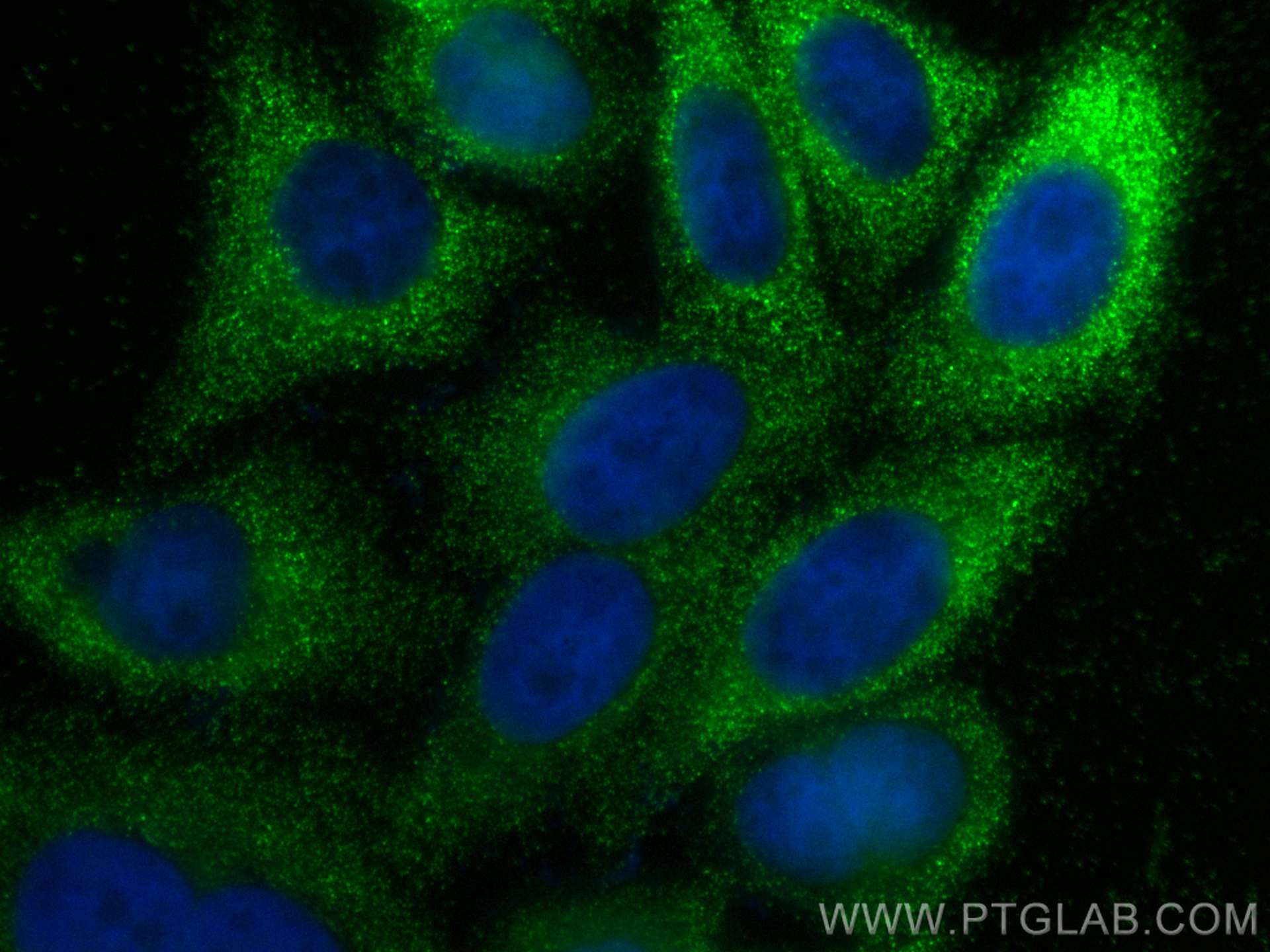 Immunofluorescence (IF) / fluorescent staining of HepG2 cells using Timp1 Polyclonal antibody (30869-1-AP)