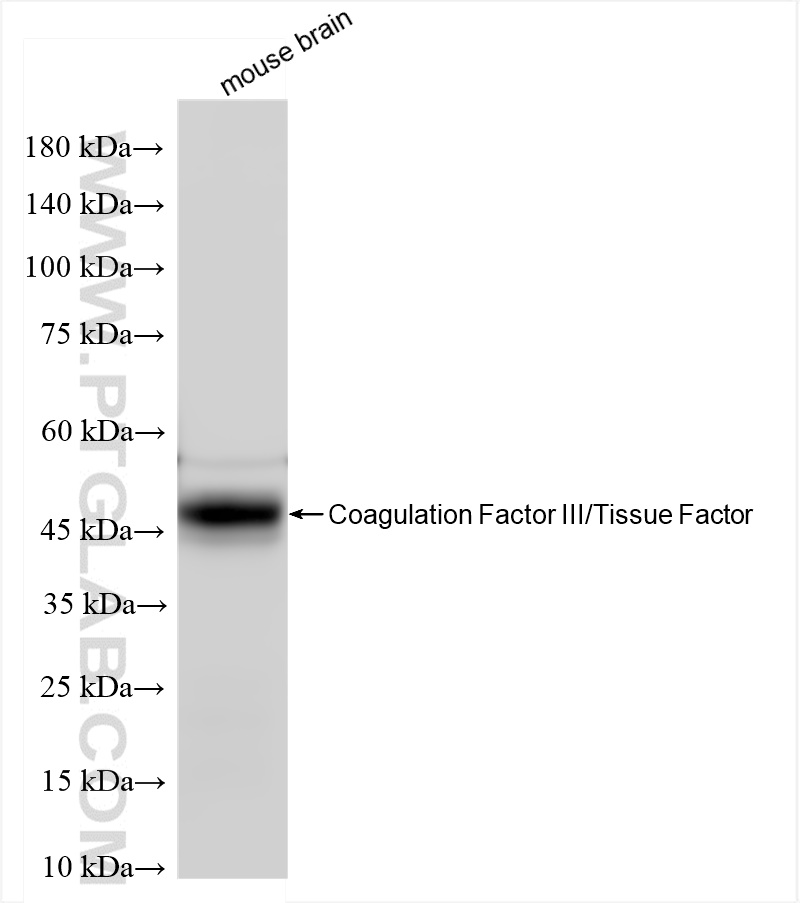 Western Blot (WB) analysis of mouse brain tissue using Tissue Factor Recombinant antibody (83887-4-RR)