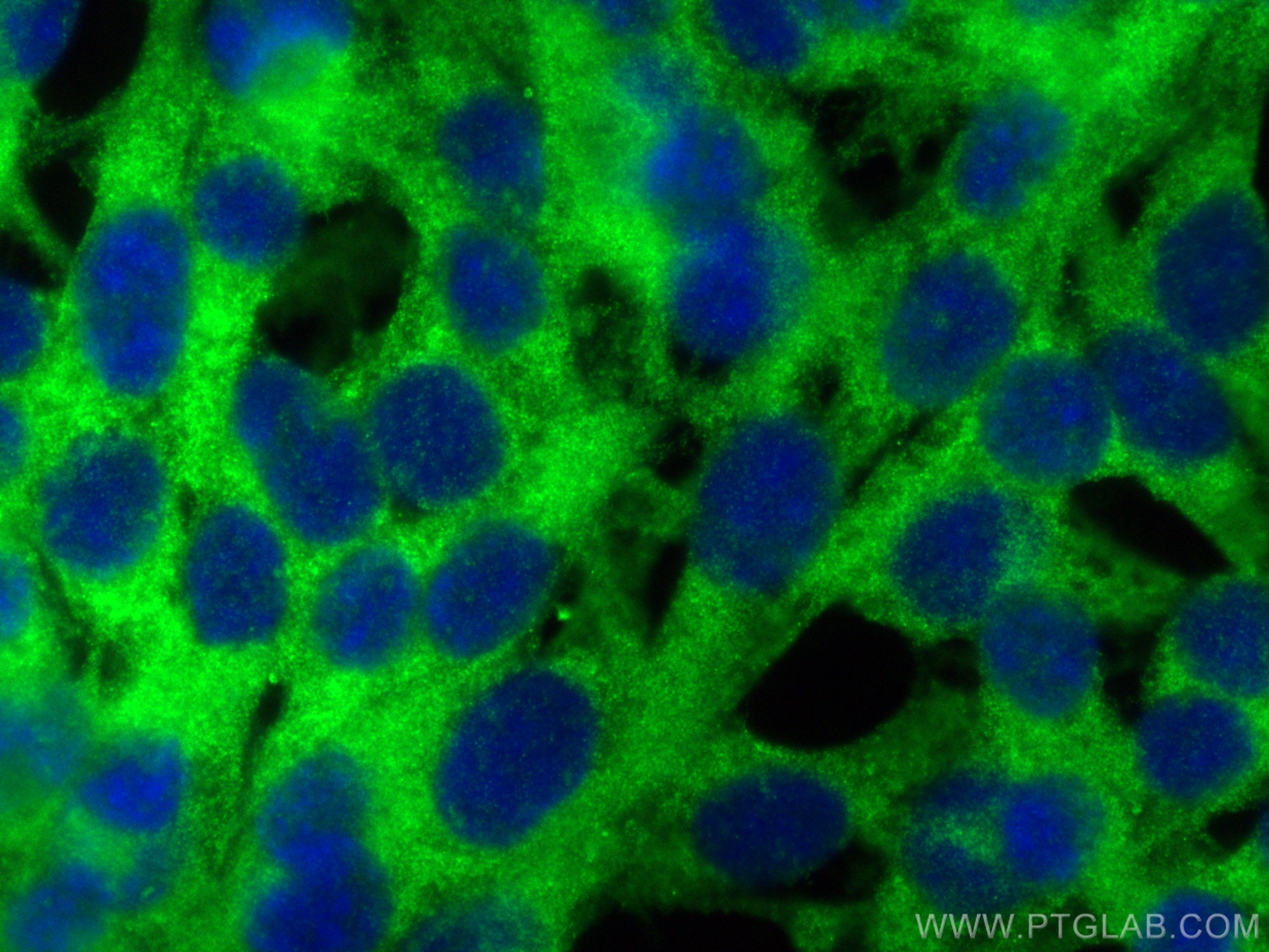 Immunofluorescence (IF) / fluorescent staining of NIH/3T3 cells using Titin Polyclonal antibody (27867-1-AP)