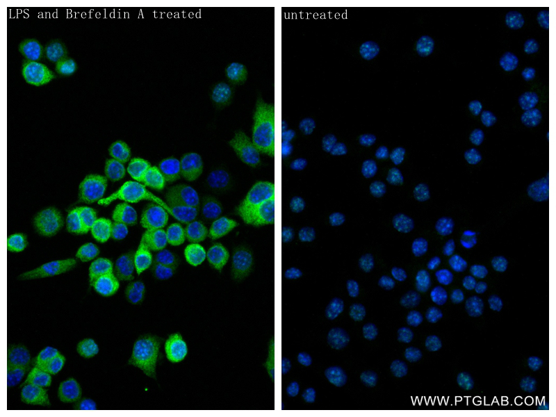 Immunofluorescence (IF) / fluorescent staining of RAW 264.7 cells using TNF-alpha Recombinant antibody (80258-6-RR)