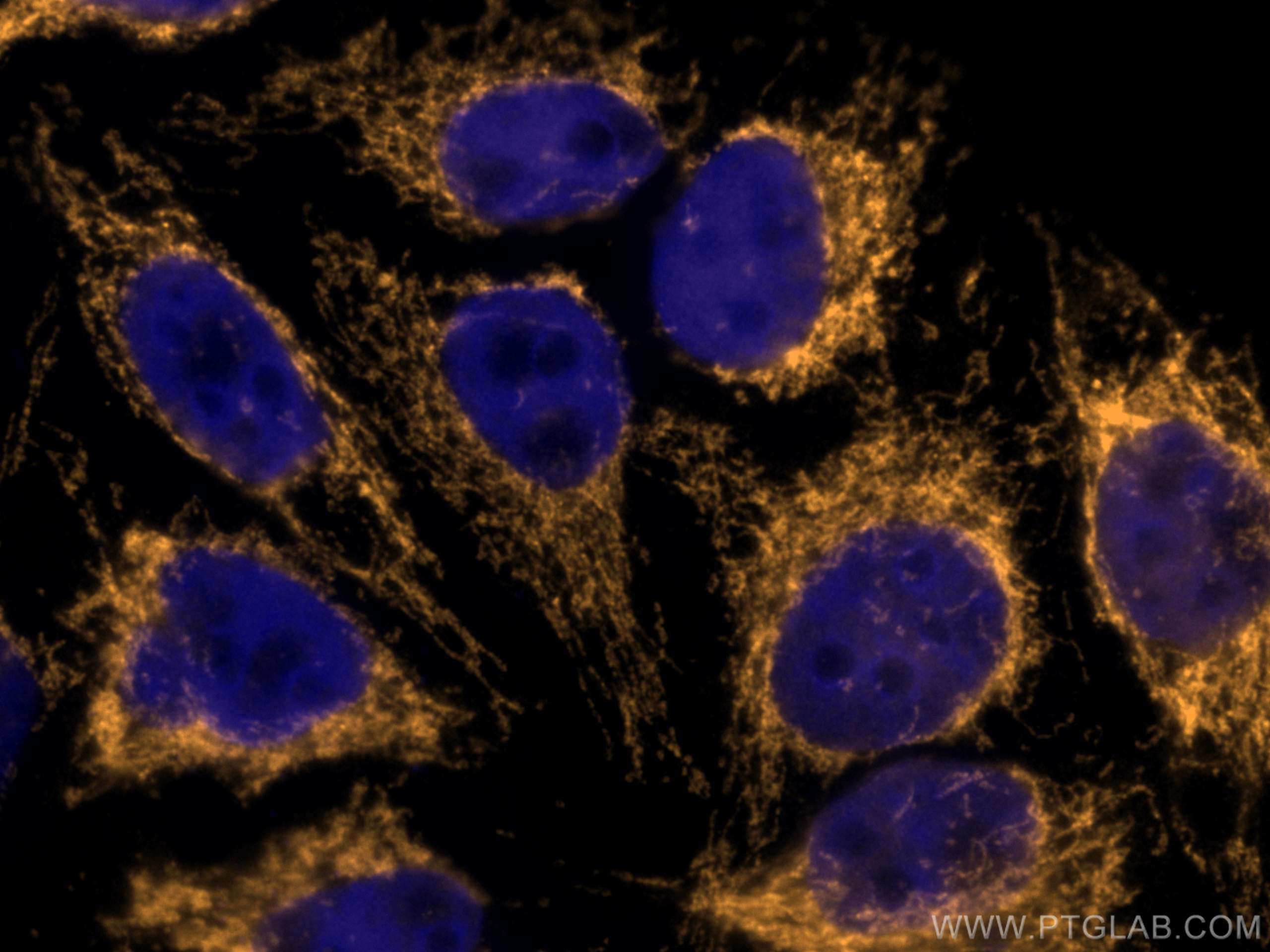 Immunofluorescence (IF) / fluorescent staining of HepG2 cells using CoraLite®555-conjugated Tom22 Monoclonal antibody (CL555-66562)