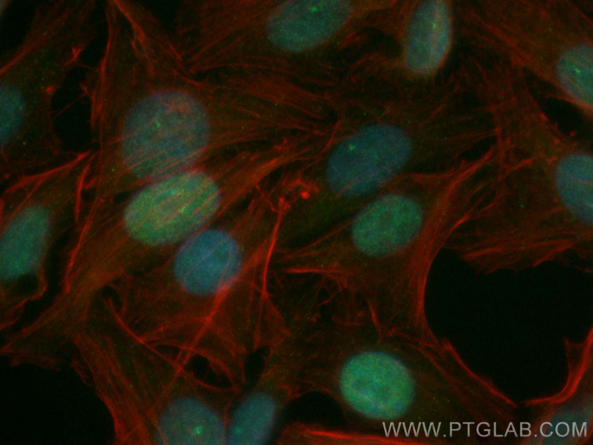 Immunofluorescence (IF) / fluorescent staining of HepG2 cells using CoraLite® Plus 488-conjugated Transketolase Monocl (CL488-66016)