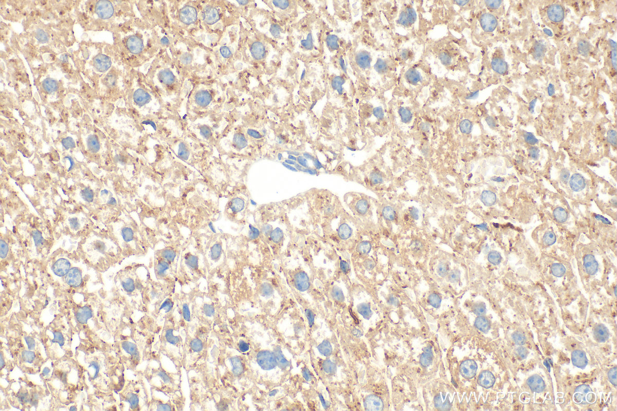 Immunohistochemistry (IHC) staining of mouse liver tissue using Transthyretin Polyclonal antibody (31130-1-AP)
