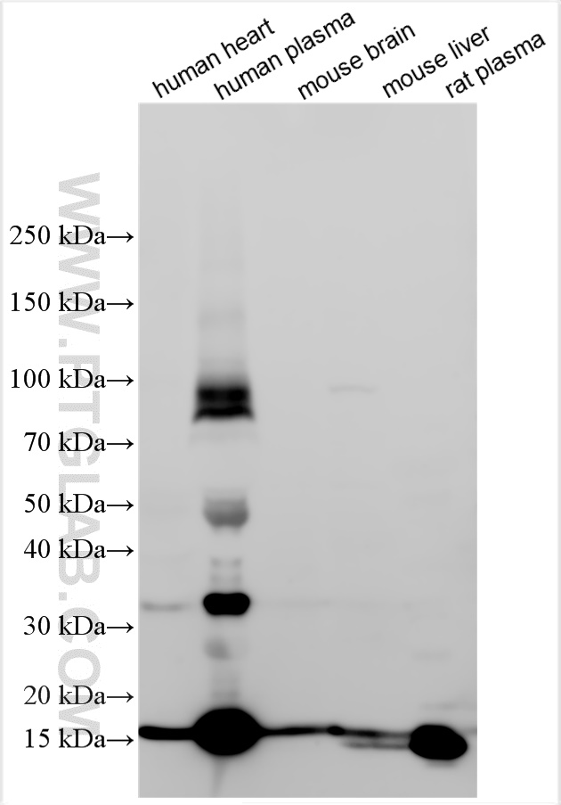 Western Blot (WB) analysis of various lysates using Transthyretin Polyclonal antibody (31130-1-AP)