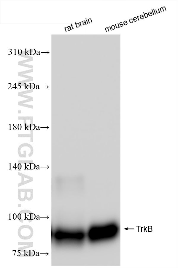 Western Blot (WB) analysis of various lysates using TrkB Recombinant antibody (80878-6-RR)