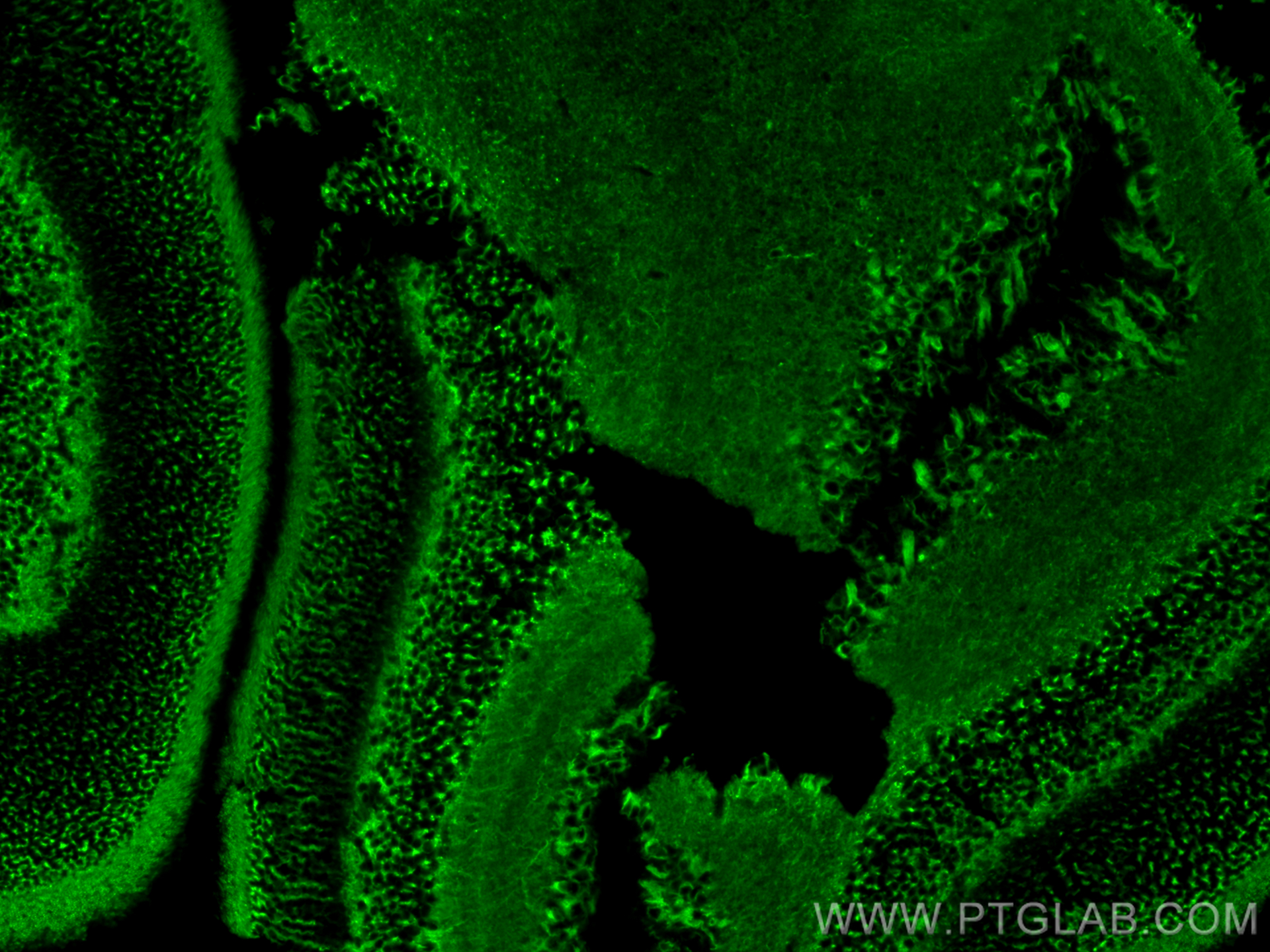 Immunofluorescence (IF) / fluorescent staining of mouse eye tissue using Beta Tubulin Monoclonal antibody (66240-1-Ig)