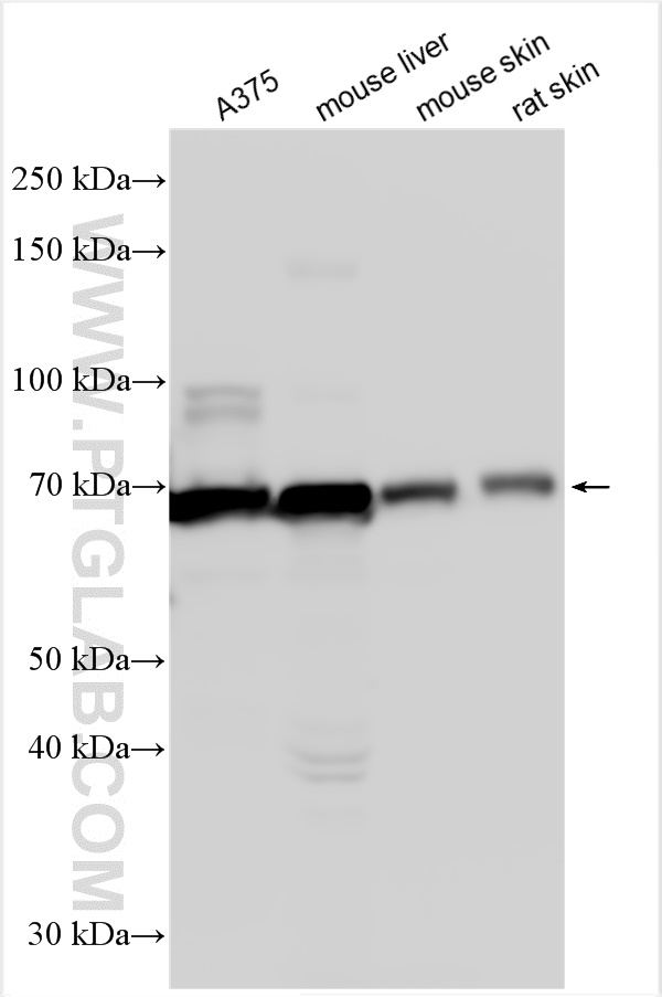 Western Blot (WB) analysis of various lysates using Tyrosinase Polyclonal antibody (31291-1-AP)