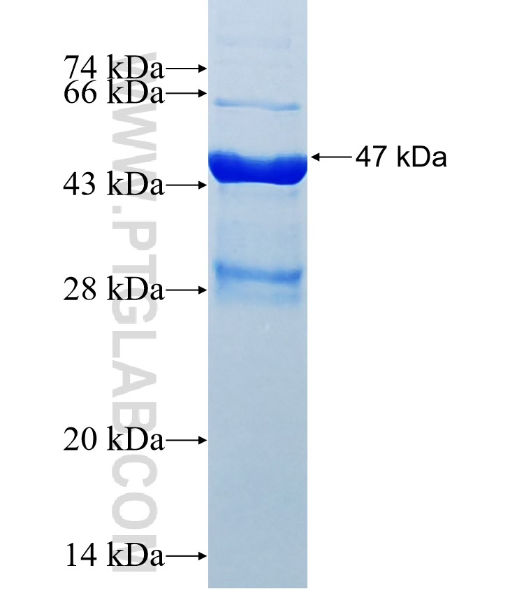 Tyrosinase fusion protein Ag34940 SDS-PAGE