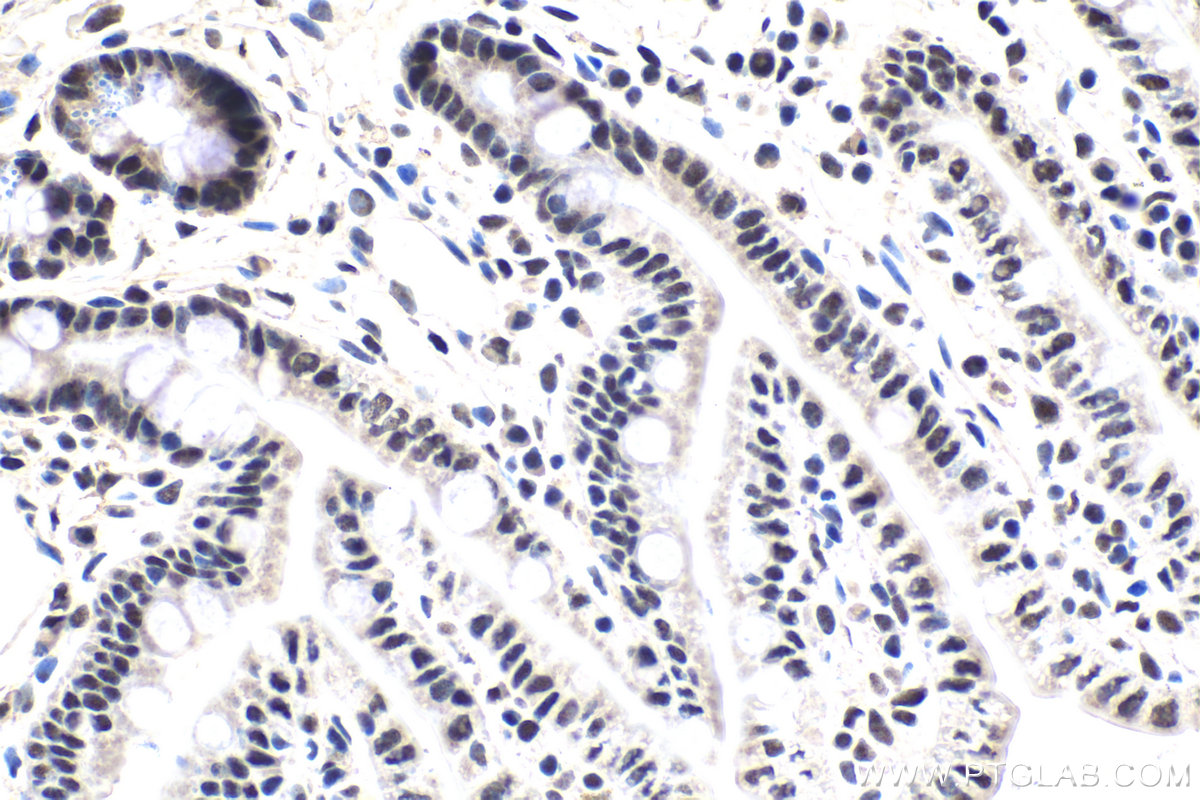 Immunohistochemistry (IHC) staining of mouse small intestine tissue using U2AF35 Polyclonal antibody (10334-1-AP)