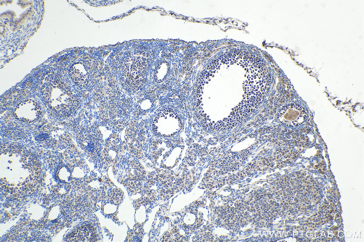 Immunohistochemistry (IHC) staining of mouse ovary tissue using UBA52 Polyclonal antibody (18039-1-AP)