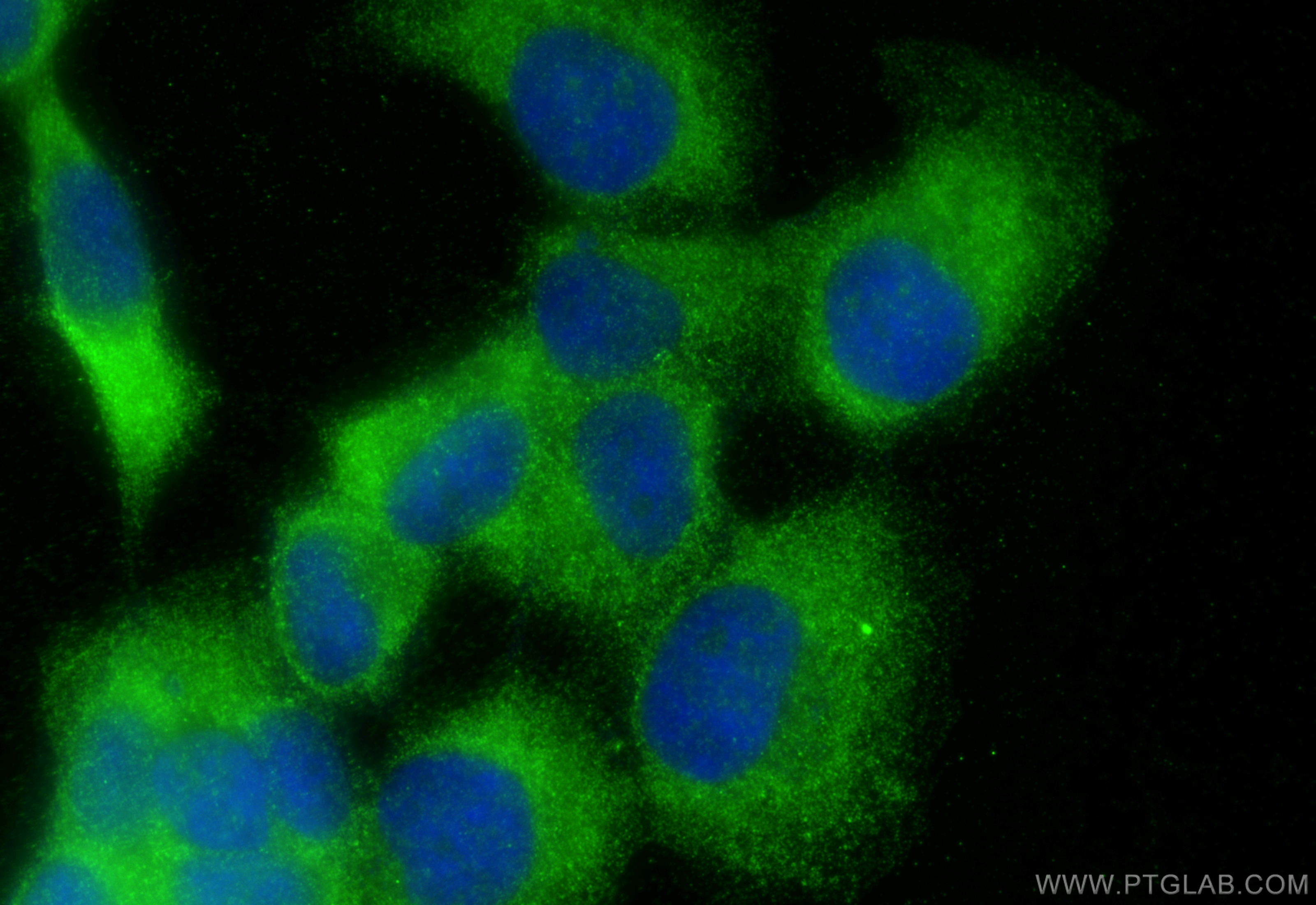 Immunofluorescence (IF) / fluorescent staining of A431 cells using UBAP1 Polyclonal antibody (12385-1-AP)