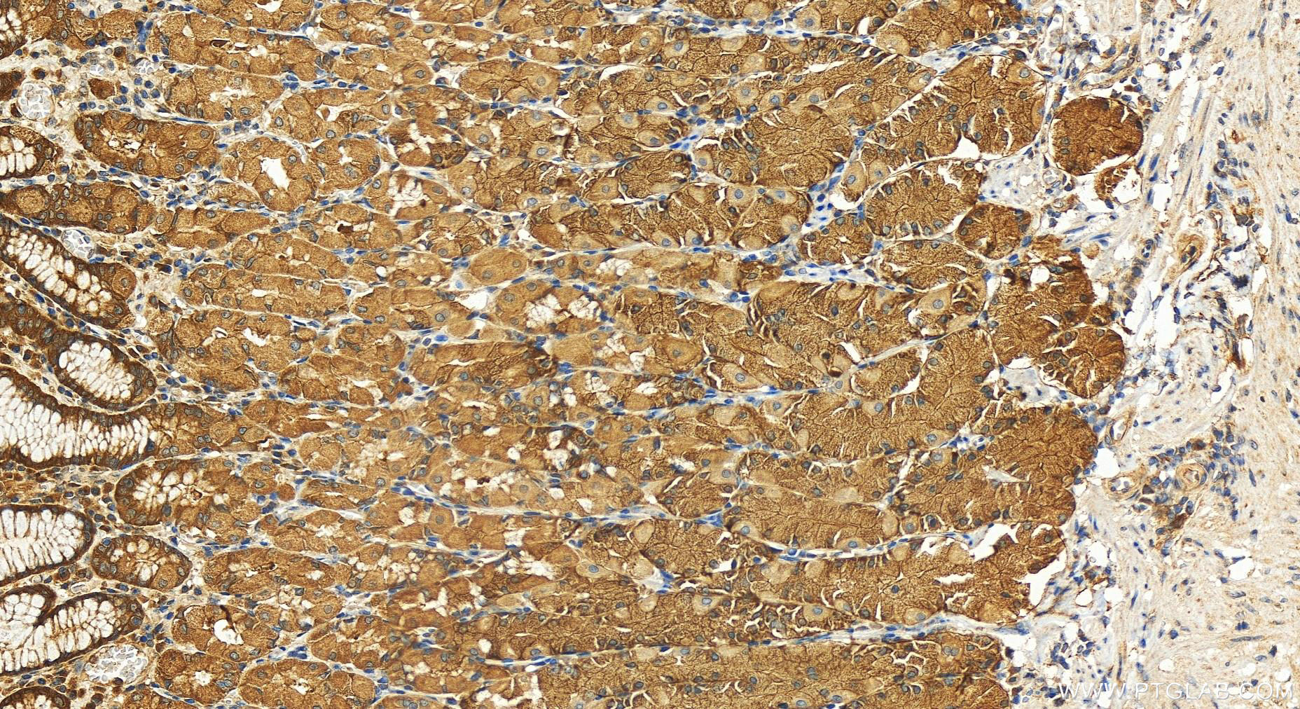 Immunohistochemistry (IHC) staining of human stomach tissue using UBE2G1 Polyclonal antibody (12012-1-AP)