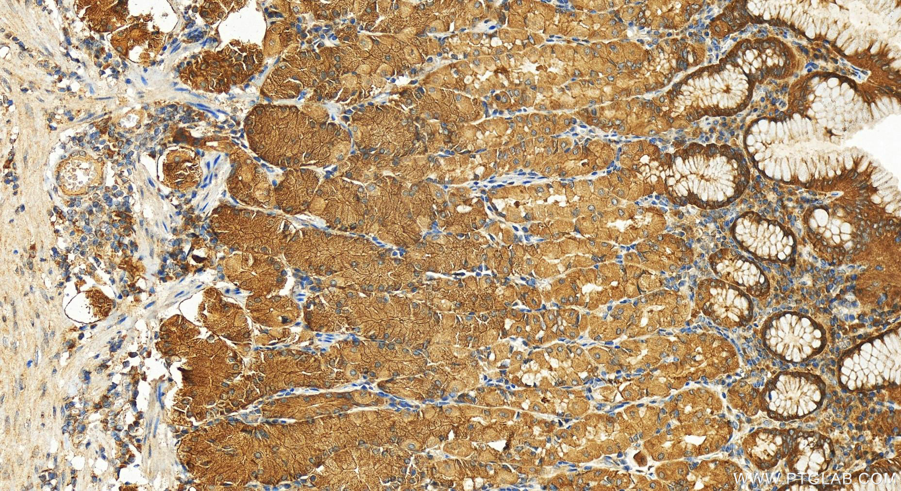 Immunohistochemistry (IHC) staining of human stomach tissue using UBE2G1 Polyclonal antibody (12012-1-AP)