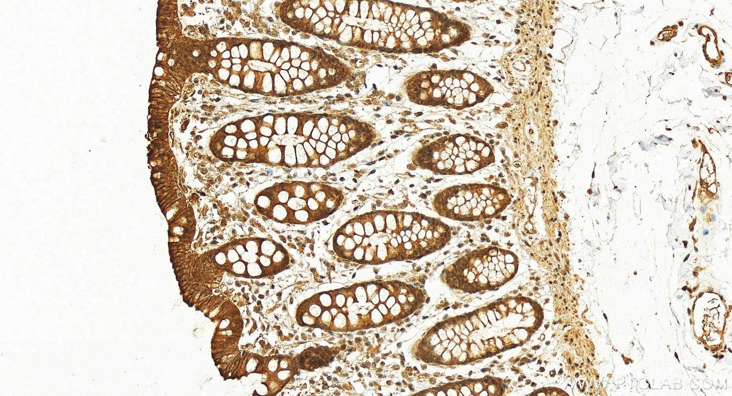 Immunohistochemistry (IHC) staining of human colon tissue using UBE2H Polyclonal antibody (15685-1-AP)