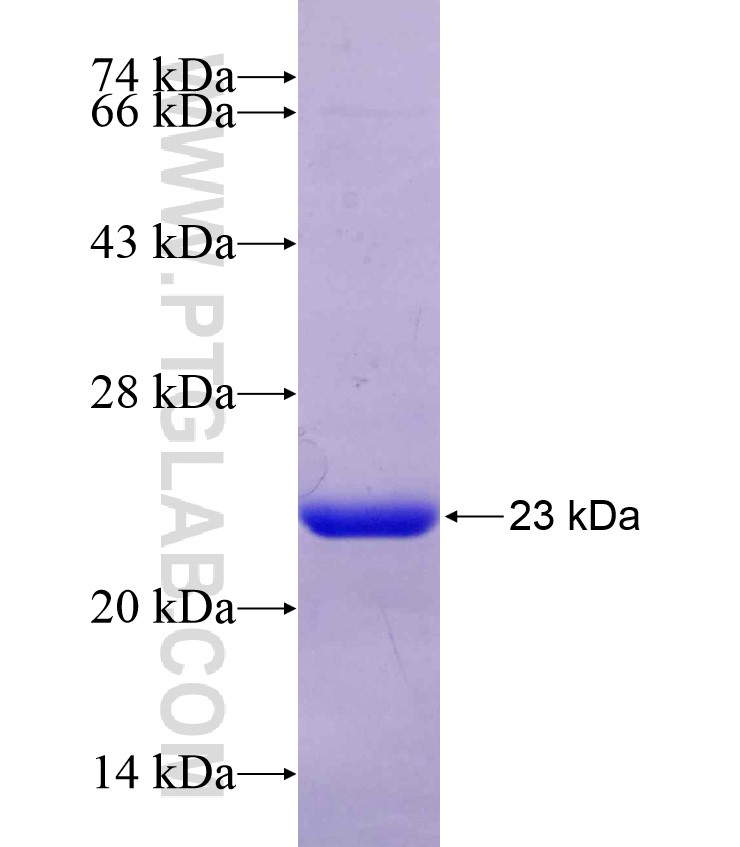 UBE2H fusion protein Ag8209 SDS-PAGE