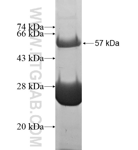 UBE2J2 fusion protein Ag12039 SDS-PAGE