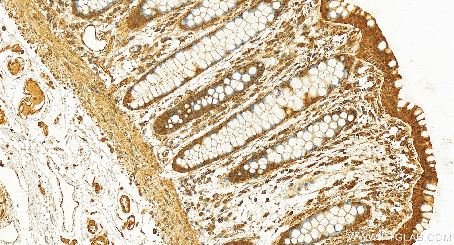 Immunohistochemistry (IHC) staining of human colon tissue using UBC13 Polyclonal antibody (10243-1-AP)