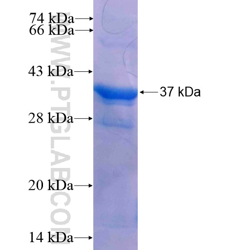 UBE2R2 fusion protein Ag5418 SDS-PAGE