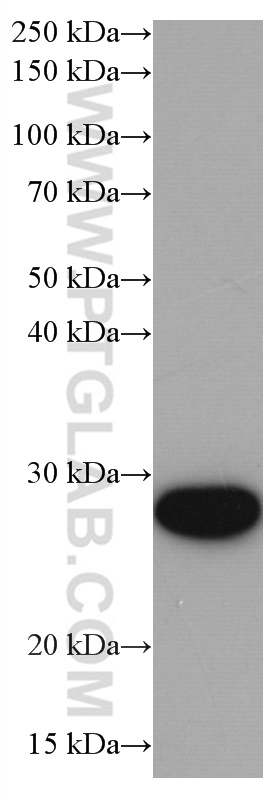 Western Blot (WB) analysis of Jurkat cells using UBE2S Monoclonal antibody (66897-1-Ig)