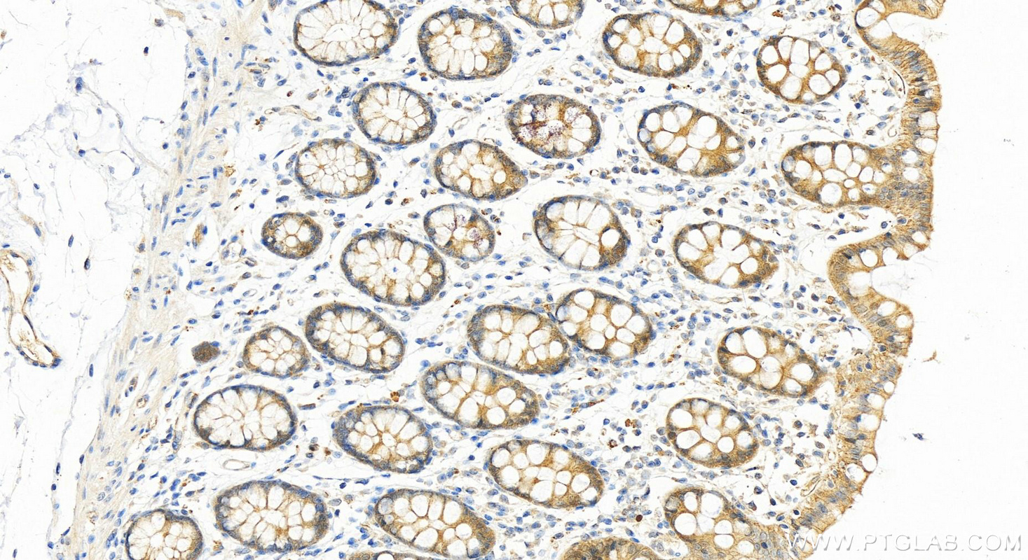 Immunohistochemistry (IHC) staining of human colon tissue using MMS2 Polyclonal antibody (10689-1-AP)