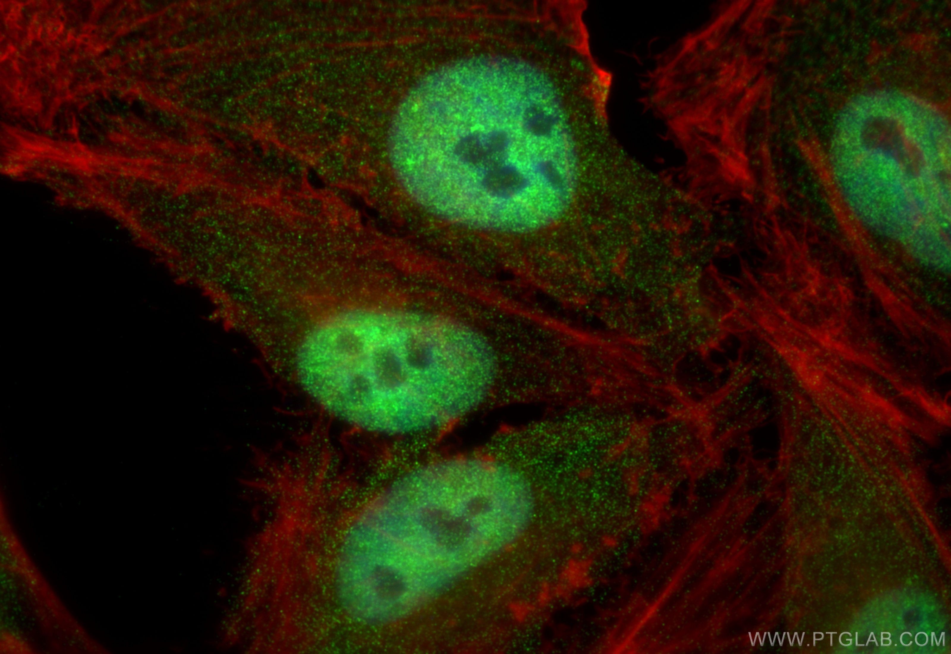 Immunofluorescence (IF) / fluorescent staining of HeLa cells using UBE3A Polyclonal antibody (10344-1-AP)