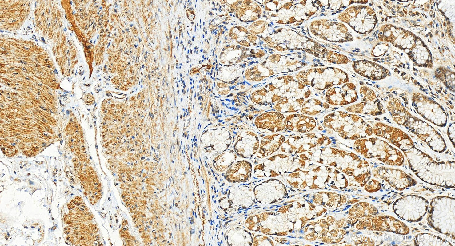 Immunohistochemistry (IHC) staining of human stomach tissue using UBE3C Polyclonal antibody (12333-1-AP)