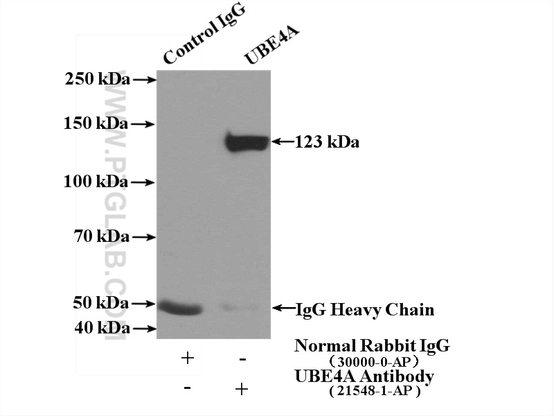 Immunoprecipitation (IP) experiment of mouse brain tissue using UBE4A Polyclonal antibody (21548-1-AP)