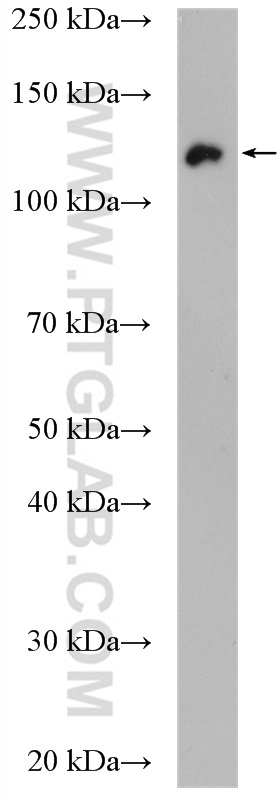 Western Blot (WB) analysis of L02 cells using UBE4A Polyclonal antibody (21548-1-AP)