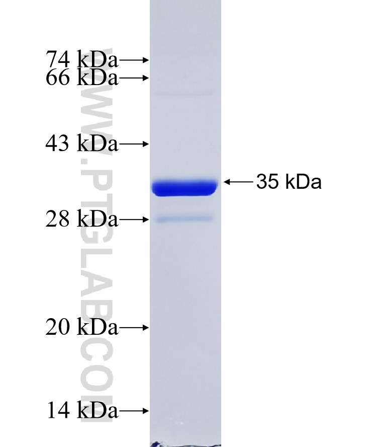 UBL5 fusion protein Ag1122 SDS-PAGE