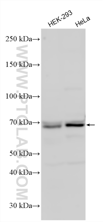 Western Blot (WB) analysis of various lysates using Ubiquilin 2 Polyclonal antibody (23449-1-AP)