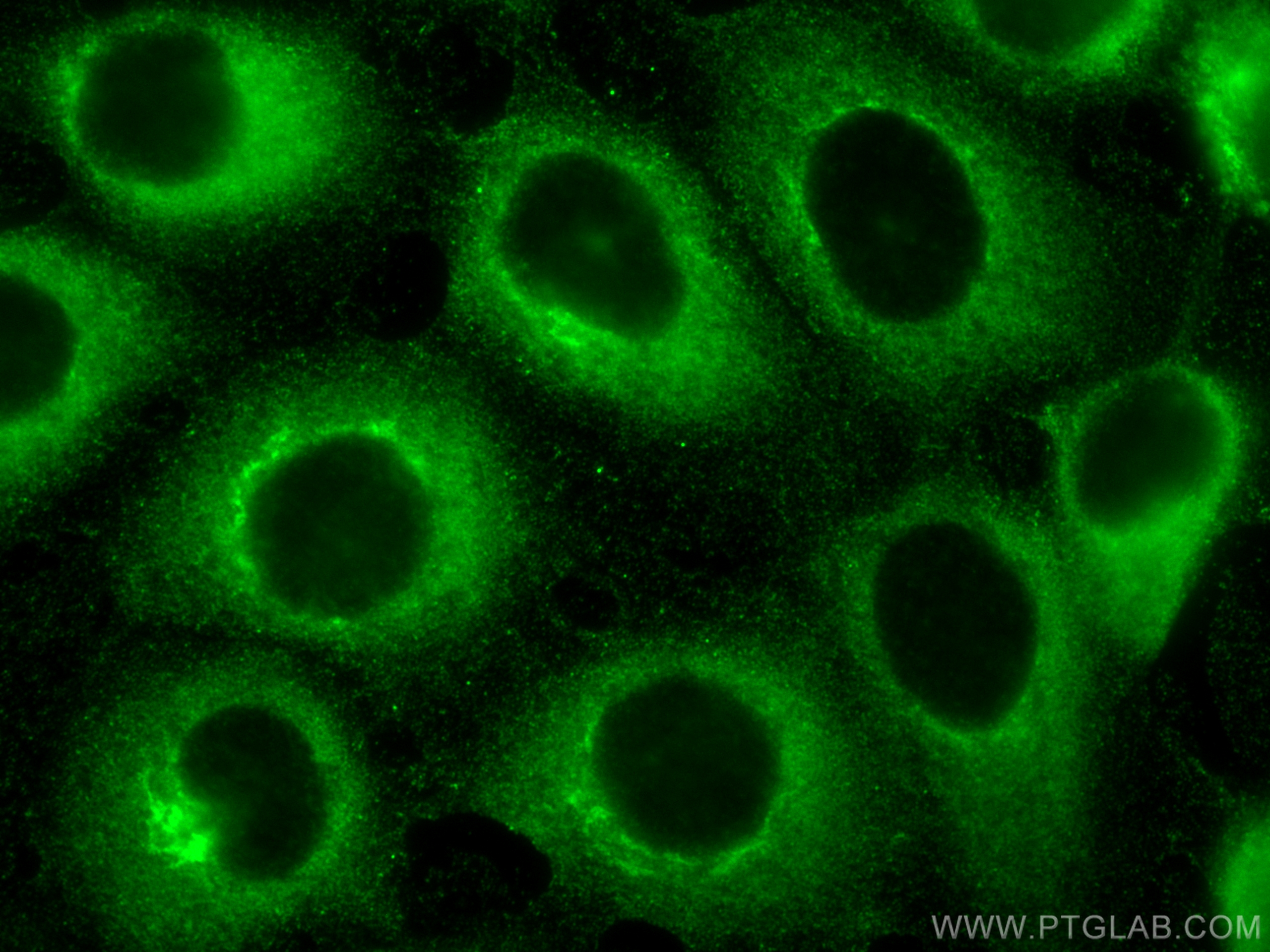 Immunofluorescence (IF) / fluorescent staining of A431 cells using UBQLNL Polyclonal antibody (16400-1-AP)