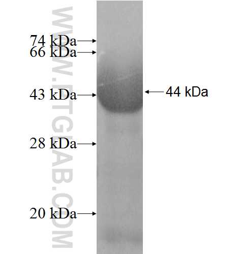 UBQLNL fusion protein Ag9475 SDS-PAGE