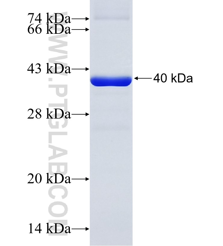 UBR5 fusion protein Ag18753 SDS-PAGE