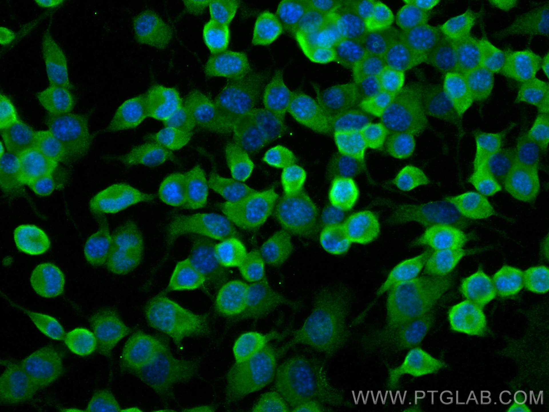 Immunofluorescence (IF) / fluorescent staining of Neuro-2a cells using UBXN2B Polyclonal antibody (25141-1-AP)