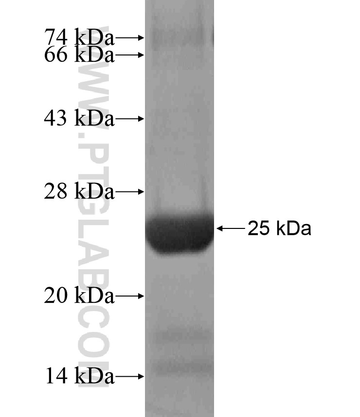 UBXN2B fusion protein Ag18259 SDS-PAGE