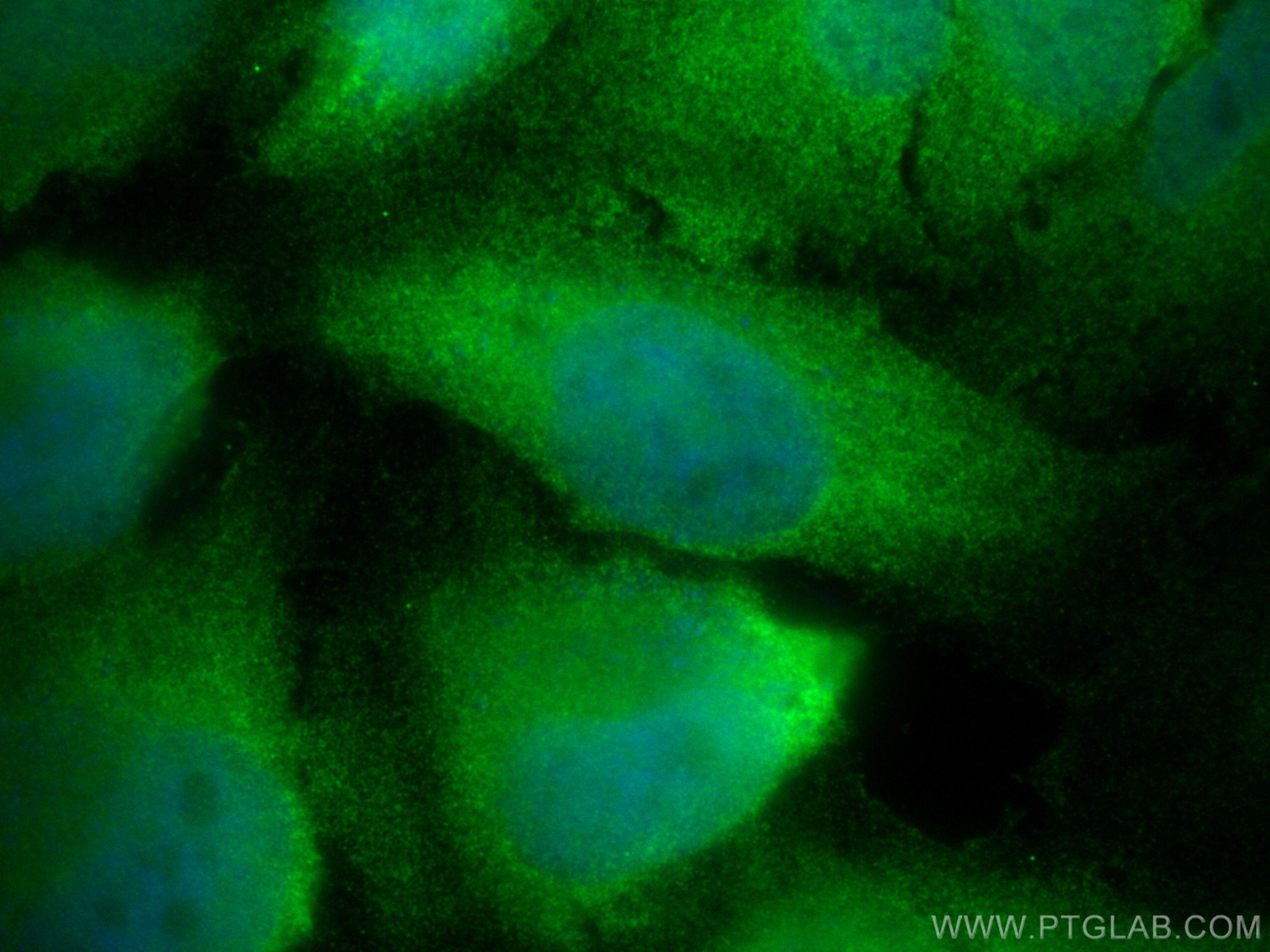 Immunofluorescence (IF) / fluorescent staining of HeLa cells using UBXD1 Polyclonal antibody (14706-1-AP)