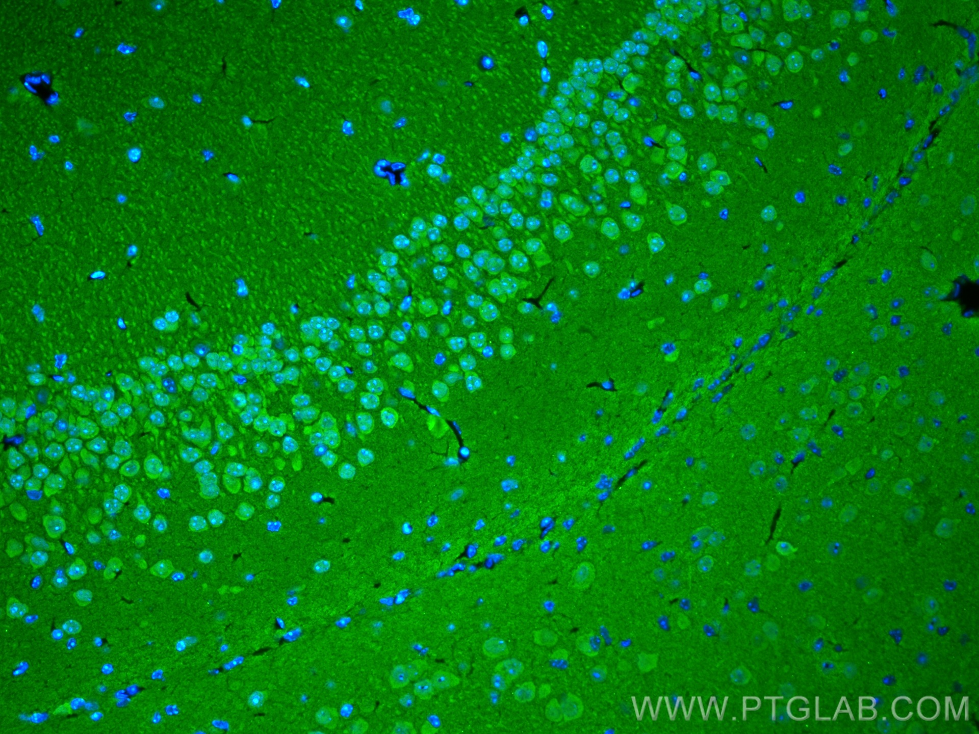 Immunofluorescence (IF) / fluorescent staining of mouse brain tissue using UCHL1/PGP9.5 Polyclonal antibody (14730-1-AP)