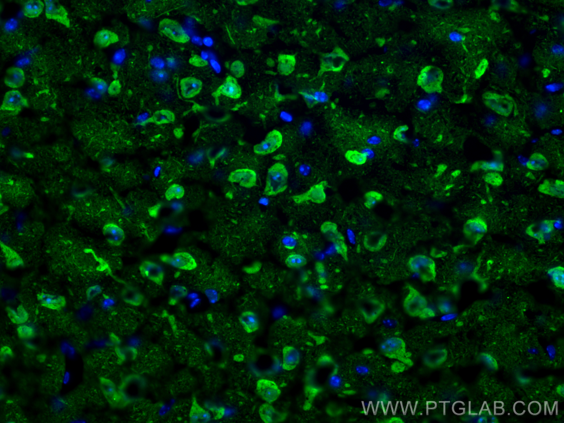 Immunofluorescence (IF) / fluorescent staining of mouse brain tissue using UCH-L1/PGP9.5 Polyclonal antibody (14730-1-AP)