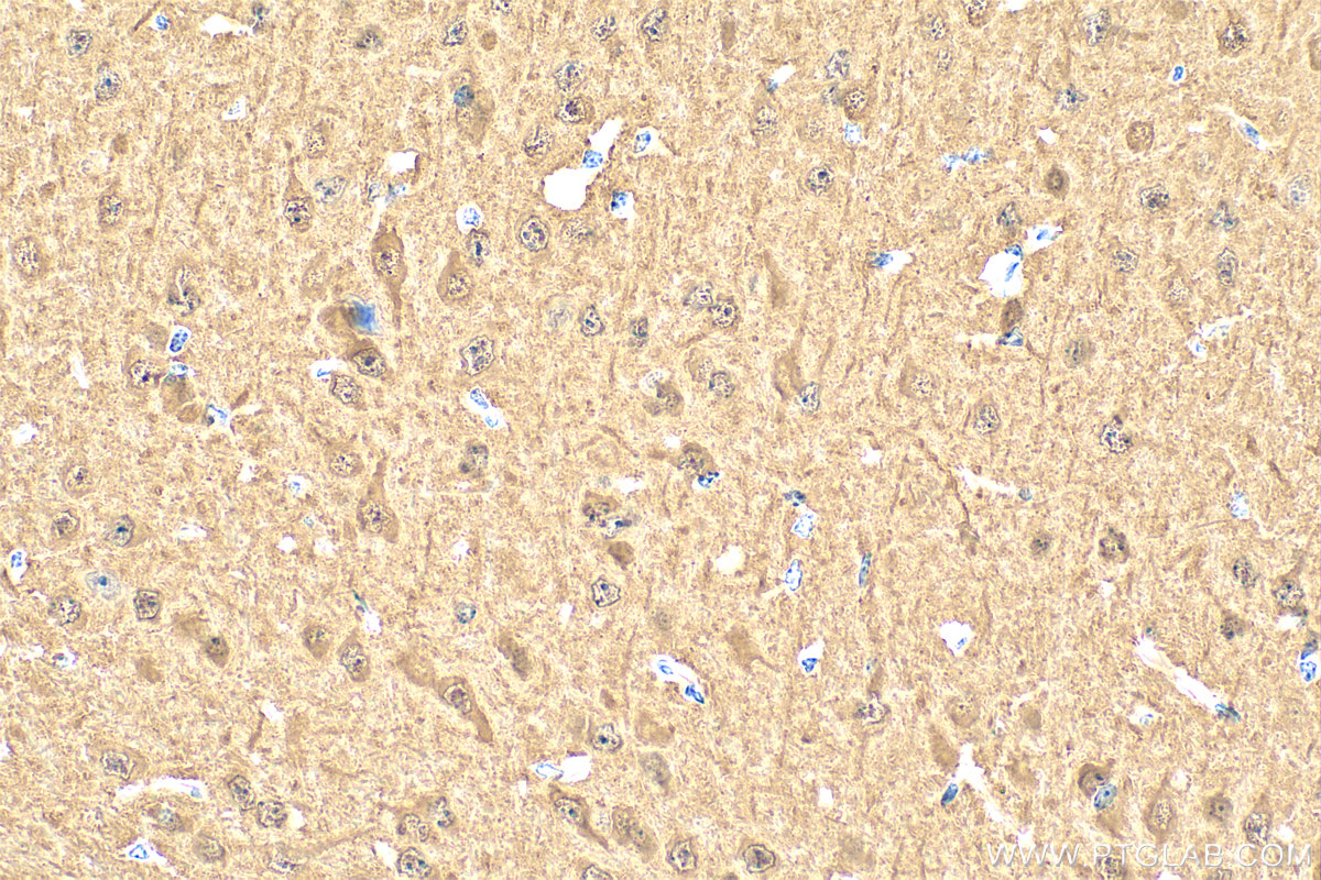 Immunohistochemistry (IHC) staining of mouse brain tissue using UCHL1/PGP9.5 Polyclonal antibody (14730-1-AP)