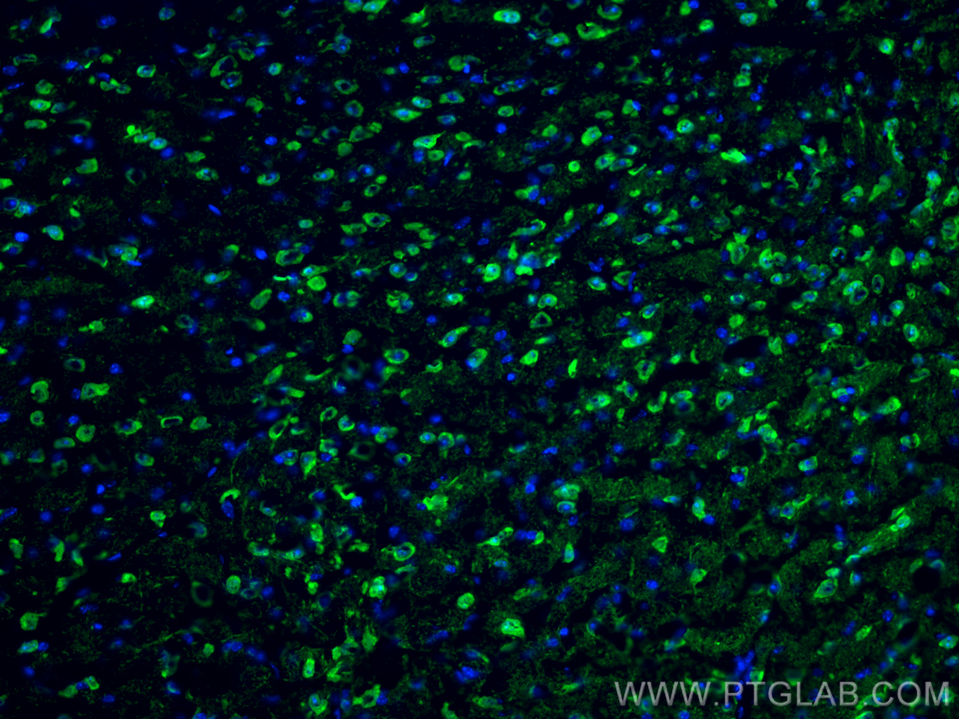 Immunofluorescence (IF) / fluorescent staining of mouse brain tissue using UCH-L1/PGP9.5 Monoclonal antibody (66230-1-Ig)