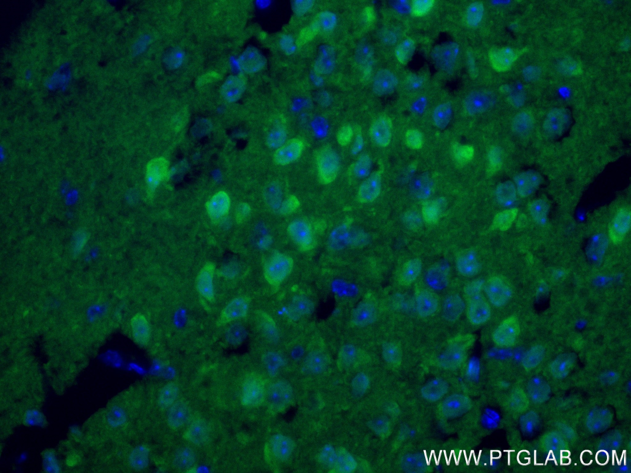 Immunofluorescence (IF) / fluorescent staining of mouse brain tissue using UCH-L1/PGP9.5 Recombinant antibody (84154-4-RR)