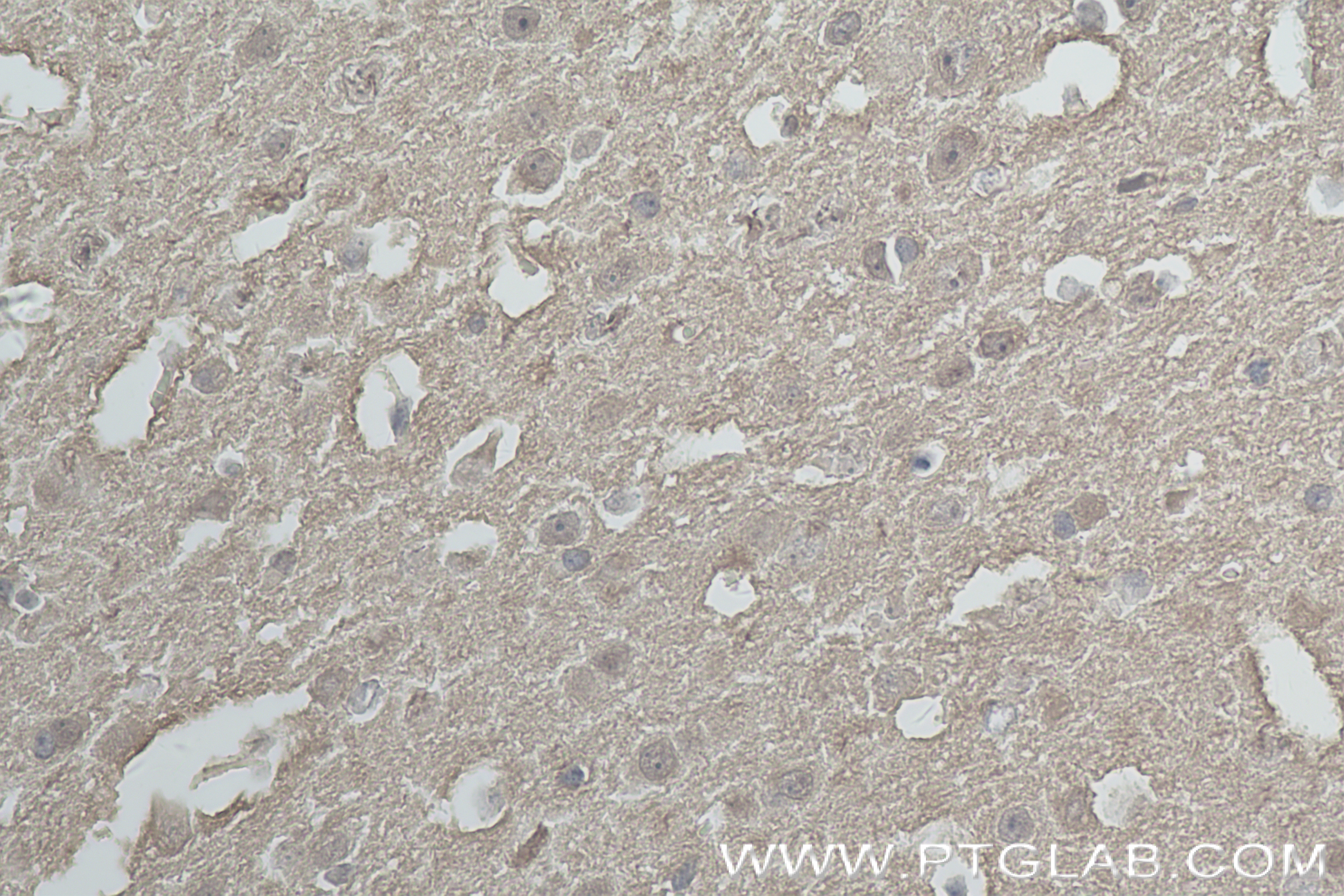 Immunohistochemistry (IHC) staining of mouse brain tissue using UCH-L1/PGP9.5 Recombinant antibody (84154-4-RR)