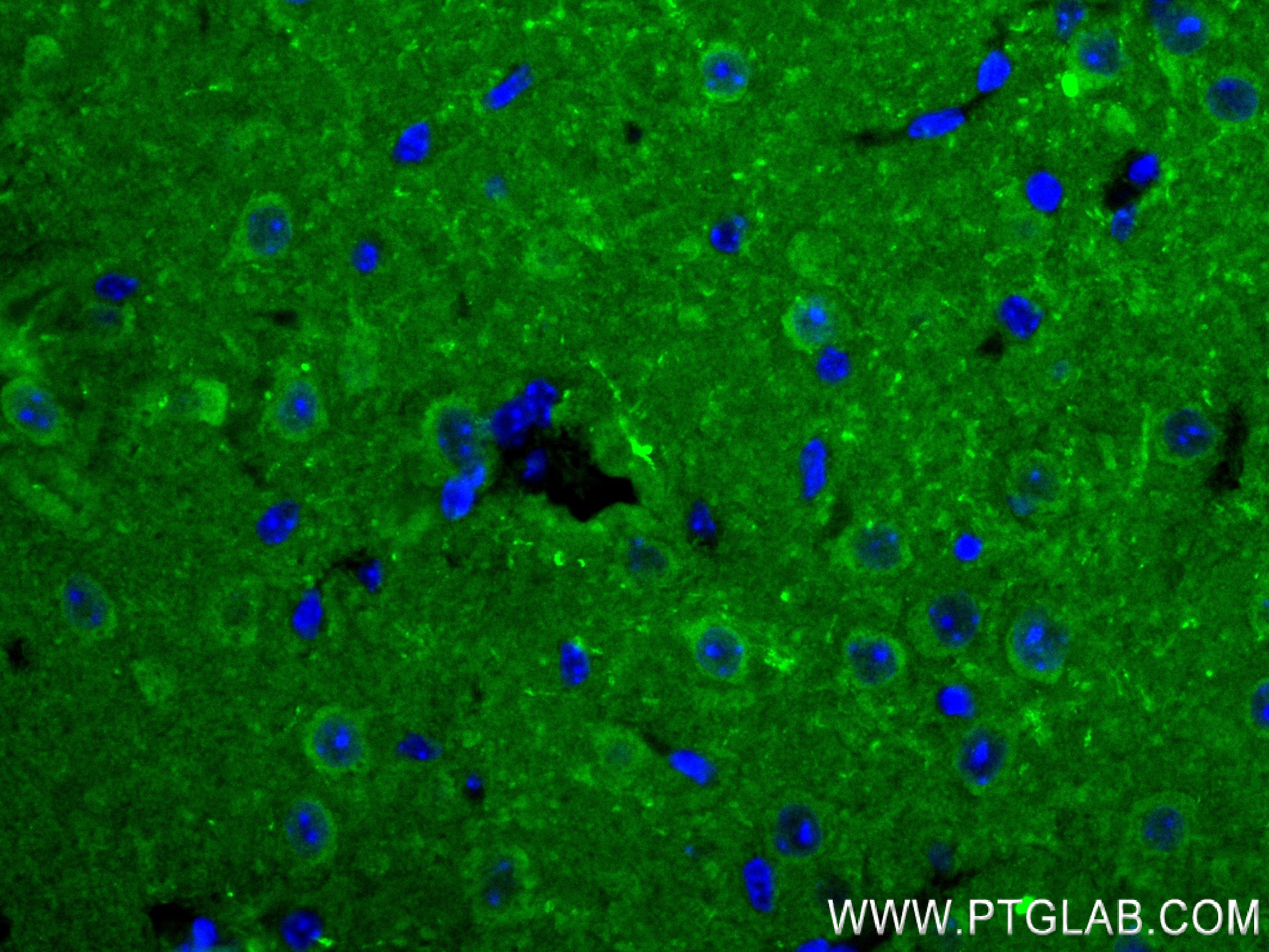 Immunofluorescence (IF) / fluorescent staining of mouse brain tissue using UCH-L1/PGP9.5 Recombinant antibody (84154-5-RR)