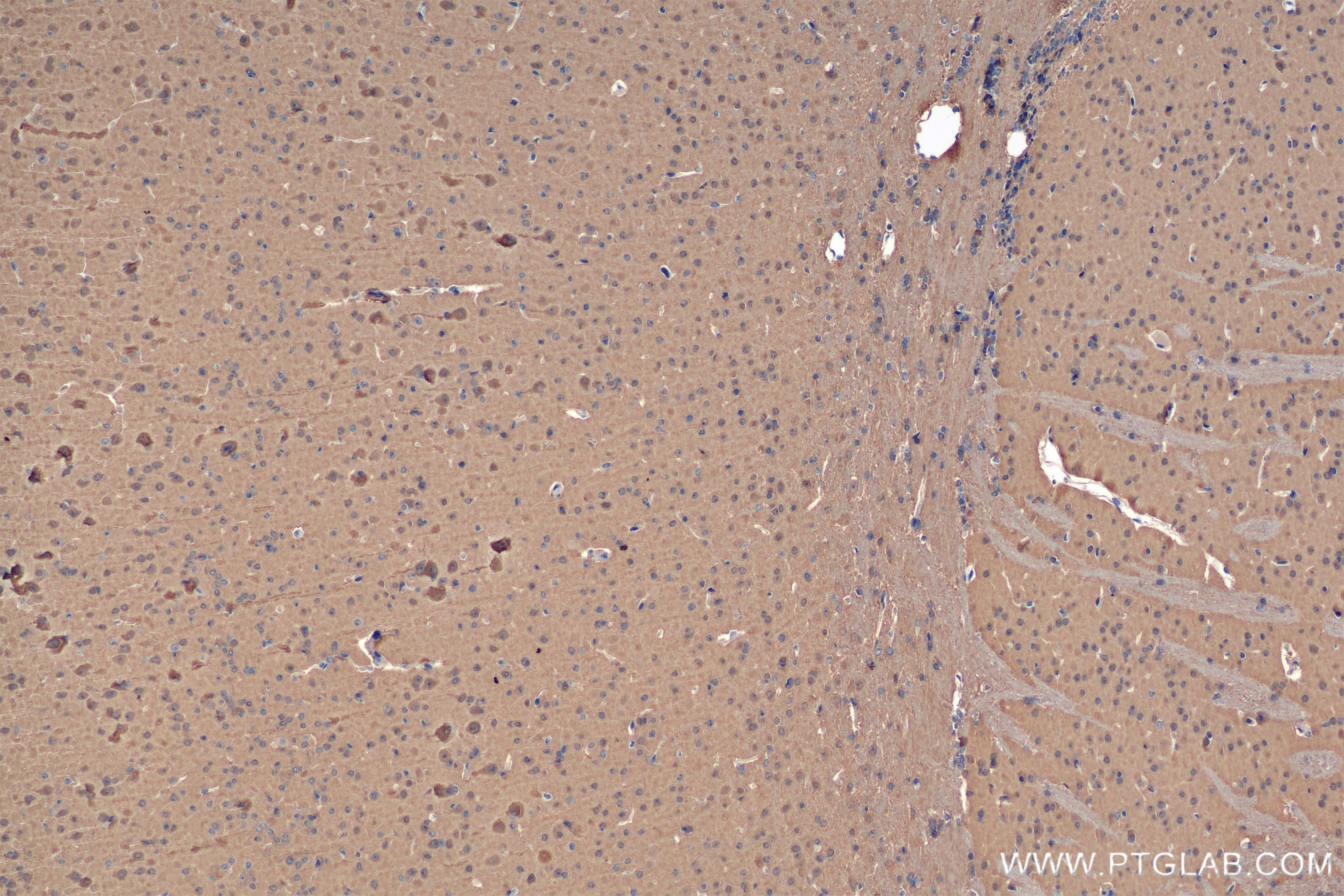 Immunohistochemistry (IHC) staining of mouse brain tissue using UCH-L1/PGP9.5 Recombinant antibody (84154-5-RR)