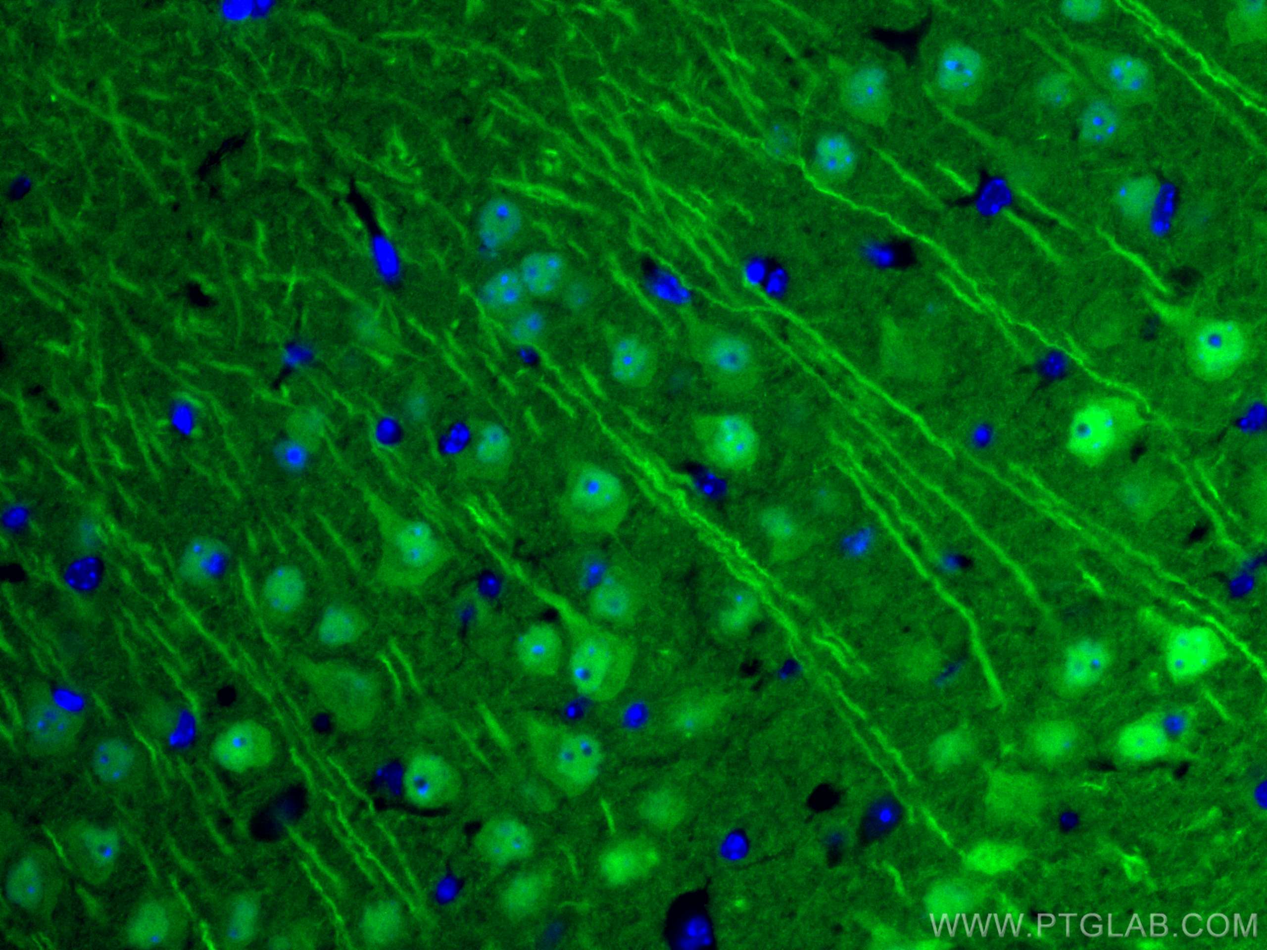 Immunofluorescence (IF) / fluorescent staining of mouse brain tissue using CoraLite® Plus 488-conjugated UCHL1/PGP9.5 Polyclo (CL488-14730)